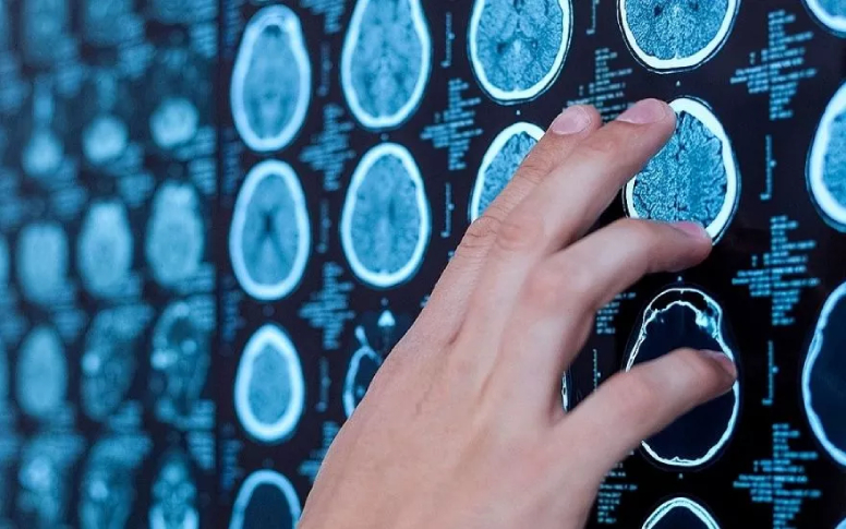 Şüpheli ALS Vakalarını Ultrason Cihazları Tespit Edilebilecek