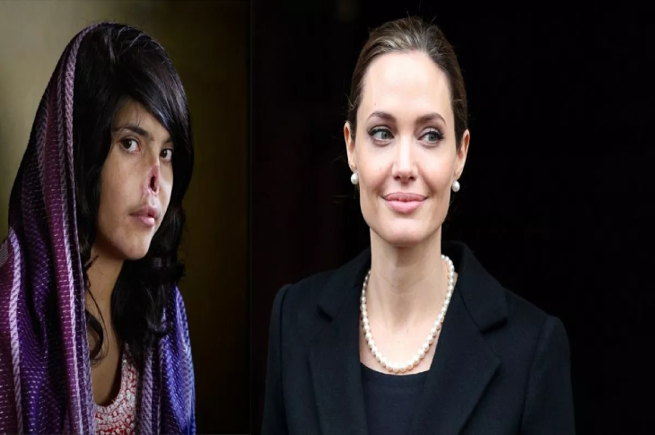 Kocası Tarafından Burnu Kesilen Bibi Aisha ile Angelina Jolie Konuştu