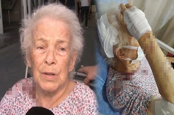 İstanbul’da Sahibinden Kaçan Maymun, Kanser Hastası Yaşlı Kadına Saldırdı