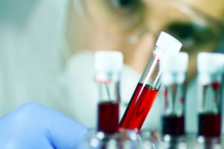 Haberi temsilen, cam tüpteki kan örnekleri objektife yansıyor.