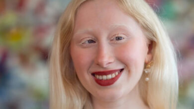 Albino ve yüzde 95 engelli sosyal medya fenomeni Ayşenur Sena Tarakçı'nın yakın çekim fotoğrafında, kaş, kirpik ve saçı beyaz renkte ve gülümsüyor.