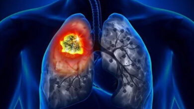 Bir insan vücudu üzerine akciğeri gösteren bir görüntüleme yöntemiyle sarı renk ile işaretlenmiş.