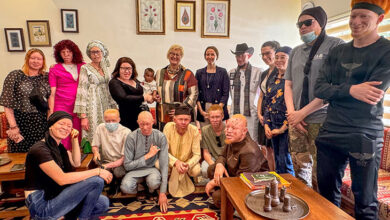 Albinolu bireyler bazıları ayakta, bazıları diz üzerine çökerek iki sıra şeklinde durup fotoğraf çekiliyorlar.