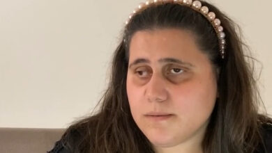 Görseldeki Elif Kain, yüzü yuvarlak, göz altları içe çökmüş, başında pembe bir tonda inci büyüklüğünde birçok yuvarlak boncuğun dizili olduğu bir tokayı, siyah renkli saçına takıyor.