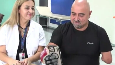 Gazi Jandarma Uzman Çavuş Yılmaz Yiğit ampute olan eline takılan biyonik el ile akıllı telefon kullanıyor.