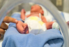 Fotoğrafta bir yenidoğan bebek, kuvöz içinde yatarken görülüyor. Bebek mavi bir örtünün üzerinde yatmakta ve sağ bacağı açıkta. Sol alt köşede bir yetişkinin eli, bebeğin ayağına dokunuyor. Bebeğin üzerinde beyaz bir bebek bezi var ve arka plan bulanık bir şekilde hastane ortamını yansıtıyor.