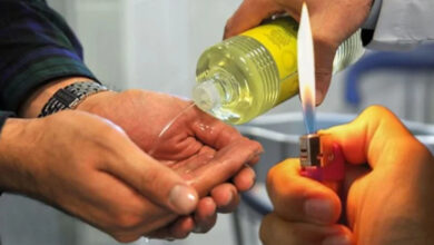 Görselde, bir kişinin avuç içine şeffaf sıvı (muhtemelen kolonya) döküldüğü görülüyor. Aynı anda başka bir el, yanan bir çakmak tutuyor. Ortam kapalı bir alan gibi görünüyor. Bu sahne, yanıcı maddelerle tehlikeli bir deneyin yapıldığını düşündürüyor. Görsel, özellikle TikTok ve sosyal medyada popüler olan ancak ciddi yaralanmalara yol açabilecek "kolonya yakma" akımıyla ilgili olabilir.