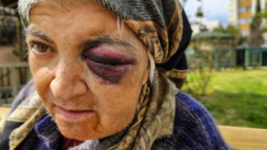 Bu fotoğraf, Antalya'da yaşanan bir saldırı olayının mağduru olan zihinsel engelli Lütfiye Yıldırım'ı gösteriyor. Görselde, yaşlı bir kadın başörtülü ve morluklarla kaplanmış bir gözle görülüyor. Yüzündeki yaralar ve ifadesi, yaşadığı şiddeti ve mağduriyetini yansıtıyor. Arka planda açık hava, park veya bahçe gibi bir alan dikkat çekiyor.