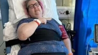 Görselde, hastane ortamında bir yatakta oturur pozisyonda bulunan bir kadın yer alıyor. Kadın gözlük takıyor ve mor-mavi tonlarında desenli bir elbise giymiş. Kollarında hastane bileklikleri var ve bel bölgesinde destekleyici bir kemer bulunuyor. Yanında medikal cihazlar ve mavi bir perde dikkat çekiyor. Kadının ifadesi rahatsızlık ya da acı hissettiğini gösteriyor. Bu görüntü, bir hastane sürecini veya tedavi sonrası durumu yansıtıyor olabilir.