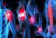 Görselde, insan iskelet sisteminin bilgisayar ortamında hazırlanmış renkli bir temsili görülüyor. Omuz, diz, kalça ve omurga gibi eklem bölgeleri kırmızıyla vurgulanmış, bu da ağrı veya sorunlu bölgeleri işaret ediyor. Arka plan koyu, kemikler mavi tonlarda gösterilmiş.