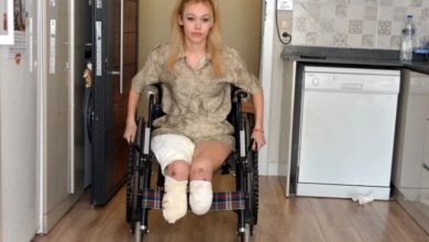 İrem Karatutlu'nun tekerlekli sandalye kullanıyor ve ampute edilen bacakları sargı içinde.