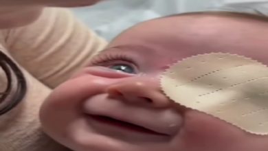 Yakın çekimde bir bebeğin yüzü görülüyor. Bebeğin bir gözü bantla kapatılmış, diğer gözü açık ve parlak şekilde bakıyor. Gülümseyen bebek neşeli bir ifade sergilerken, yanında ona yakın duran bir yetişkinin kolu da kadraja girmiş.