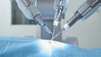 Görselde, modern bir ameliyathane ortamında robotik cerrahi müdahale anı betimleniyor. Üç adet ileri teknoloji ürünü metalik robotik kol, mavi bir örtüyle kaplı hastanın vücudundaki tek bir küçük kesi noktasına (single-port) odaklanmış durumda. Kolların uçlarındaki hassas cerrahi aletler, operasyonun gerçekleştiği noktada birleşiyor. Arka planda ise tıbbi cihazların bulanık, steril ve beyaz ağırlıklı detayları görülüyor.