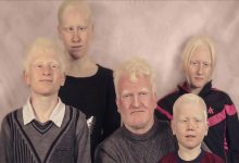 Görselde, beş kişiden oluşan bir grup birlikte poz veriyor. Hepsinin çok açık ten rengi, açık sarı–beyaza yakın saçları ve açık kaş–kirpikleri dikkat çekiyor. Arka plan sade bir stüdyo fonu gibi. Kişiler farklı yaşlarda; ortada yetişkin bir erkek, etrafında ise dört genç ve çocuk bulunuyor. Kamera karşısında sakin ve doğal bir şekilde poz veriyorlar.