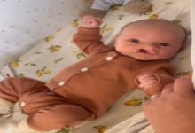 Görselde bir bebek, beşiğinde sırtüstü uzanmış şekilde görülüyor. Üzerinde kahverengi, tek parça bir tulum bulunuyor. Bebek canlı ve dikkatli bir ifadeyle kameraya bakıyor. Yüz hatlarında doğuştan gelen bir durum olan yarık dudak yapısı seçiliyor. Yan taraftan uzanan bir el, bebeğin kolunu nazikçe tutuyor. Arka planda limon desenli bir çarşaf ve yumuşak oyuncaklar dikkat çekiyor. Kare, ev ortamında çekilmiş doğal bir anı yansıtıyor.