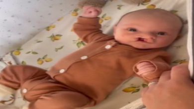 Görselde bir bebek, beşiğinde sırtüstü uzanmış şekilde görülüyor. Üzerinde kahverengi, tek parça bir tulum bulunuyor. Bebek canlı ve dikkatli bir ifadeyle kameraya bakıyor. Yüz hatlarında doğuştan gelen bir durum olan yarık dudak yapısı seçiliyor. Yan taraftan uzanan bir el, bebeğin kolunu nazikçe tutuyor. Arka planda limon desenli bir çarşaf ve yumuşak oyuncaklar dikkat çekiyor. Kare, ev ortamında çekilmiş doğal bir anı yansıtıyor.