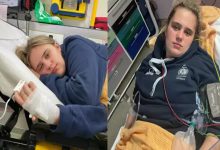 Phoebe Tesoriere, iki kolaj fotoğrafta sedyede yatıyor.