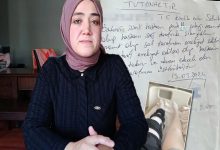 Görselde başörtülü bir kadın, kamera karşısında açıklama yaparken görülüyor. Arka planda el yazısıyla hazırlanmış bir tutanak yer alırken, köşedeki ek fotoğrafta dizinden ameliyat geçirmiş bir kişinin bacağı görüntüleniyor. Görsel, bir sağlık süreci ve yaşanan mağduriyet iddiasına ilişkin haberi yansıtıyor.
